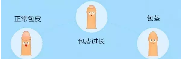 敖漢旗包皮過長對女性有傷害嗎